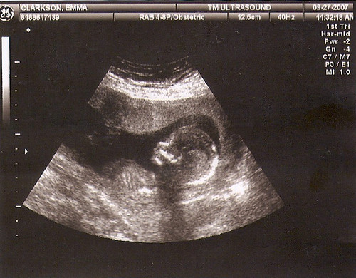 Scan1